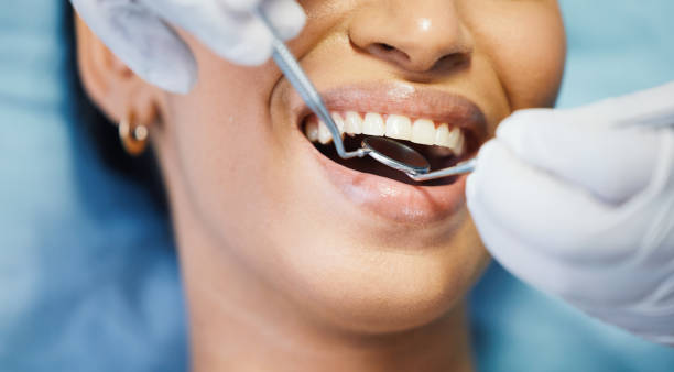 Best Broken or Chipped Tooth Repair in Sumrall, MS